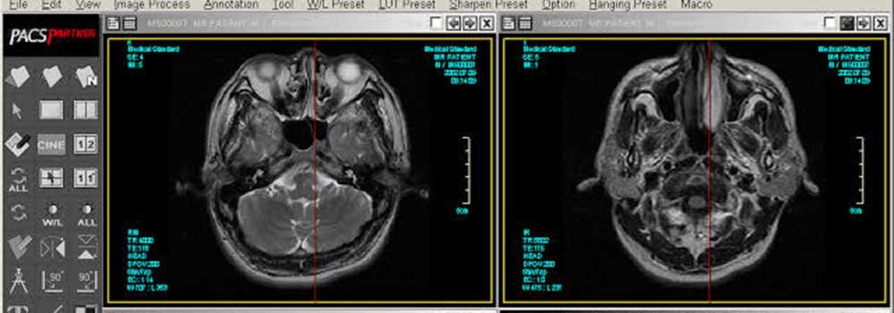 MicroDICOM-on-AmericasBestBlog